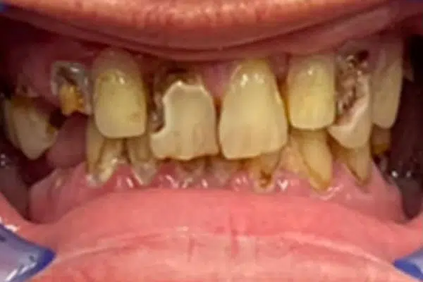 Before image